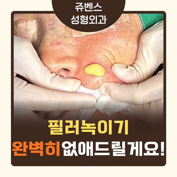 필러녹이기 쥬벤스성형외과